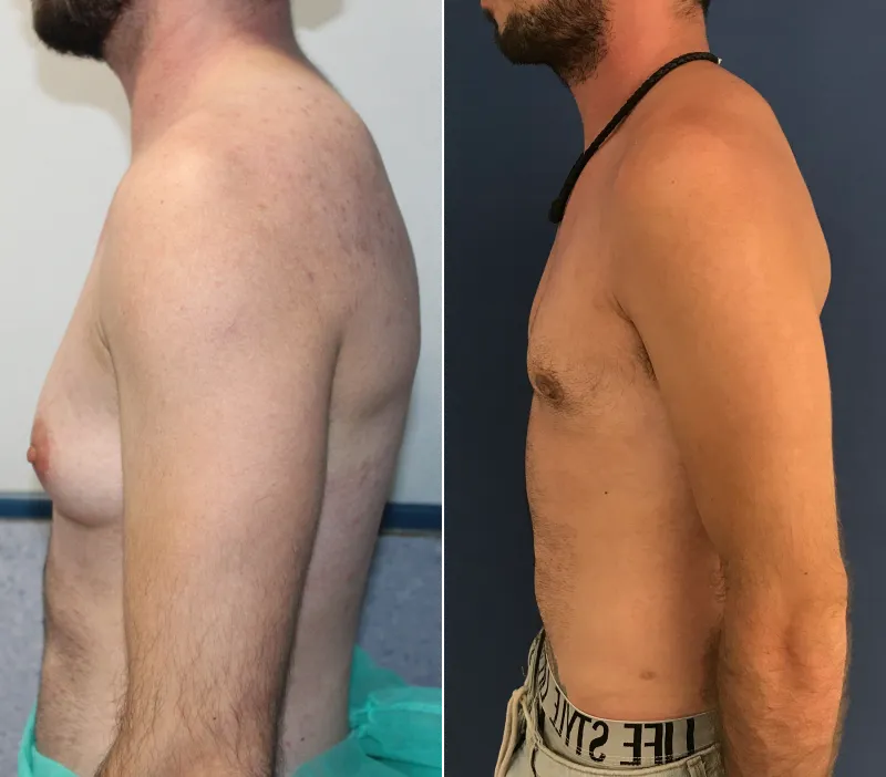 Antes-y-Despues-1-e1639430487888.png