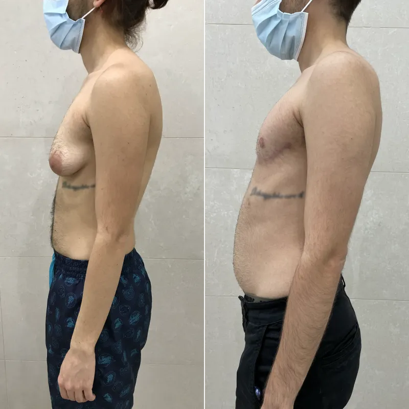 Antes-y-Despues-2-e1639430443384.png