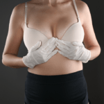 Sculpture Clinic your breast reduction clinic in Madrid Spain (1)