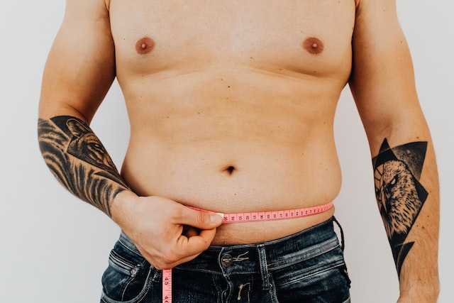 sobrepeso abdominoplastia