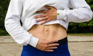 diastasis de rectos abdominales