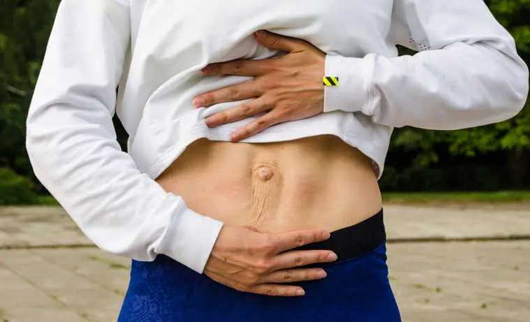 diastasis de rectos abdominales