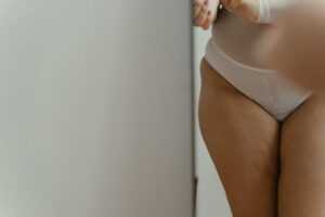 Como identificar si tengo lipedema