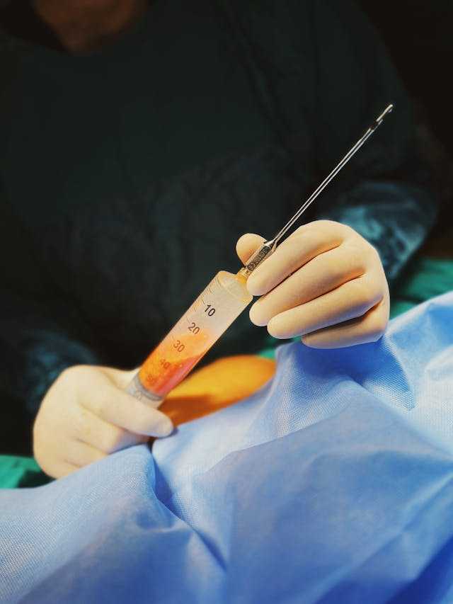 liposuccion lipedema