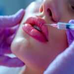 Cuanto cuesta un aumento de labios Precios