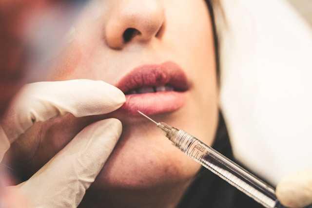 aumento de labios precios